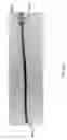 Fig. 78 - Intragastric device for treating obesity