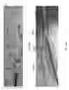 Fig. 79 - Intragastric device for treating obesity