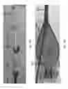Fig. 80 - Intragastric device for treating obesity