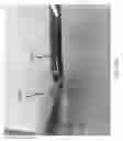 Fig. 85 - Intragastric device for treating obesity