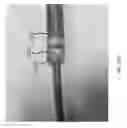 Fig. 87 - Intragastric device for treating obesity