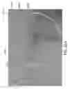 Fig. 88 - Intragastric device for treating obesity