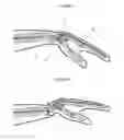 Fig. 02 - Splint