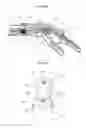 Fig. 06 - Splint