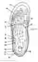 Fig. 06 - Custom multi-layered orthotic/orthosis, and method for forming