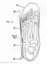 Fig. 07 - Custom multi-layered orthotic/orthosis, and method for forming