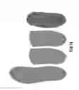 Fig. 09 - Custom multi-layered orthotic/orthosis, and method for forming
