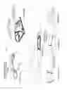Fig. 22 - Apparatus for supporting an arm during a medical procedure