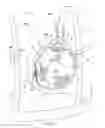 Fig. 03 - Thermal device for treating breastfeeding conditions