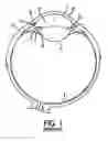 Fig. 02 - Methods and apparatuses for the treatment of glaucoma using visible and infrared ultrashort laser pulses