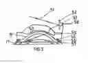 Fig. 06 - Methods and apparatuses for the treatment of glaucoma using visible and infrared ultrashort laser pulses