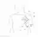 Fig. 01 - Pressure bandage