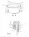 Fig. 03 - Apparatus for handling soiled articles