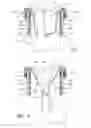 Fig. 05 - Apparatus for handling soiled articles