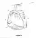 Fig. 02 - Medical device stabilization strap