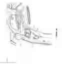 Fig. 07 - Medical device stabilization strap