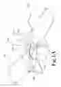 Fig. 02 - Post-Operative Assistive Device