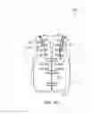 Fig. 10 - Self-contained portable positionable oscillating motor array including disposable and/or recyclable portions