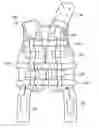 Fig. 01 - Self-contained portable positionable oscillating motor array including an outer harness providing a compressive force