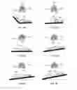 Fig. 08 - Self-contained portable positionable oscillating motor array including an outer harness providing a compressive force