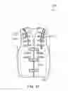 Fig. 10 - Self-contained portable positionable oscillating motor array including an outer harness providing a compressive force