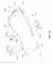 Fig. 88 - Sterile limb connectors and methods