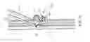 Fig. 47 - Surgical arm positioning systems and methods