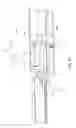 Fig. 72 - Surgical arm positioning systems and methods