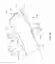 Fig. 88 - Surgical arm positioning systems and methods