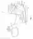 Fig. 02 - Compression therapy device having mechanical advantage