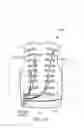 Fig. 11 - Kit for clearing a biological airway including a self-contained portable positionable oscillating motor array