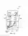Fig. 15 - Kit for clearing a biological airway including a self-contained portable positionable oscillating motor array