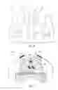 Fig. 06 - Method of clearing a biological airway using a self-contained portable positionable oscillating motor array