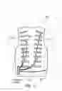 Fig. 11 - Method of clearing a biological airway using a self-contained portable positionable oscillating motor array