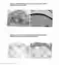 Fig. 04 - SUBSTANCE FOR RESTORING NORMAL CO-EXPRESSION AND INTERACTION BETWEEN THE LOX AND NRAGE PROTEINS