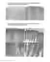 Fig. 06 - SUBSTANCE FOR RESTORING NORMAL CO-EXPRESSION AND INTERACTION BETWEEN THE LOX AND NRAGE PROTEINS