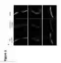 Fig. 11 - MODULATION OF MITOCHONDRIAL CALCIUM UNIPORTER ACTIVITY FOR TREATING AND PREVENTING ARRHYTHMIAS