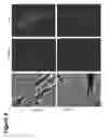 Fig. 12 - MODULATION OF MITOCHONDRIAL CALCIUM UNIPORTER ACTIVITY FOR TREATING AND PREVENTING ARRHYTHMIAS