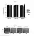 Fig. 03 - COMPOSITION COMPRISING (S)-(-)-BENPROPERINE FOR PREVENTING OR TREATING CANCER