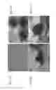 Fig. 12 - Composition for treatment of joint disease and method thereof