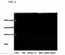 Fig. 04 - Extended release of neuregulin for improved cardiac function