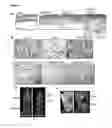 Fig. 05 - Compositions and Methods for Induced Brown Fat Differentiation