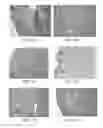 Fig. 10 - Controlled release vaccines and methods of treating diseases and disorders