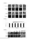 Fig. 03 - THERAPEUTIC AGENT FOR NEUROLOGICAL DISORDER