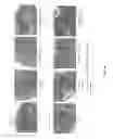 Fig. 07 - Compositions and methods for treating inflammatory bowel disease using a combination therapy of small molecule inhibitors of C-C chemokine receptor 9 (CCR9) and anti-α4β7 integrin blocking antibodies