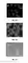 Fig. 05 - PROMOTION OF WOUND HEALING