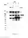 Fig. 03 - COMPOSITIONS CONTAINING HC-HA COMPLEX AND METHODS OF USE THEREOF