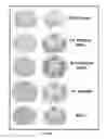 Fig. 04 - CONJUGATES COMPRISING MANNAN AND MYELIN BASIC PROTEIN (MBP)