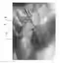 Fig. 01 - Visualization of Foreign Bodies in Tissue