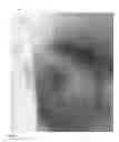Fig. 02 - Visualization of Foreign Bodies in Tissue